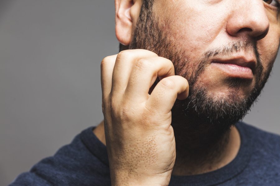Barbe qui gratte : causes et solutions pour apaiser votre peau Barbe qui gratte : causes et solutions pour apaiser votre peau