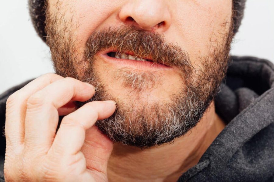 Barbe qui gratte : causes et solutions pour apaiser votre peau Barbe qui gratte : causes et solutions pour apaiser votre peau
